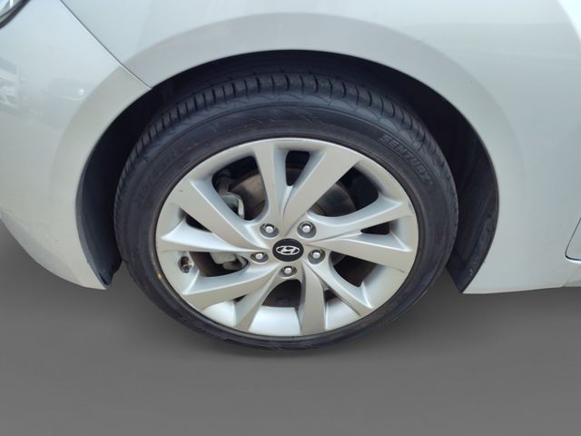 Thumbnail: 2017 Hyundai Veloster - 8
