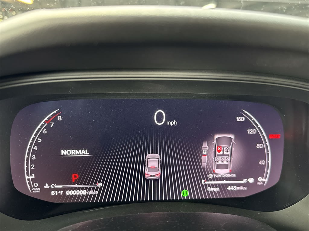 2025 Acura TLX Technology 17